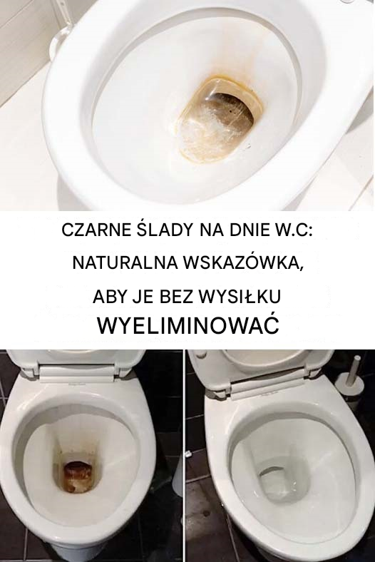 Jak usunąć czarne ślady z toalety?