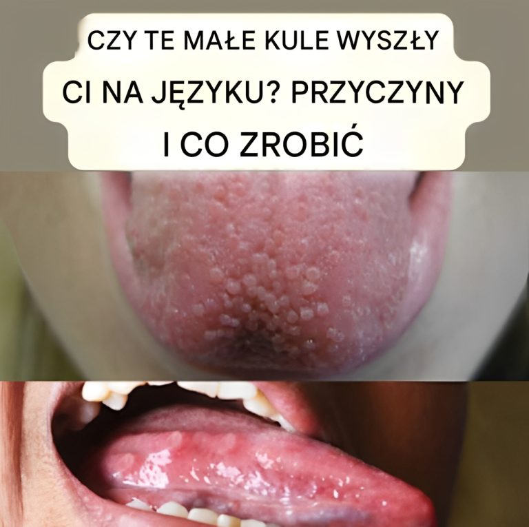 Odkryła małą ranę w ustach i zmarła po miesiącach okropnego bólu.