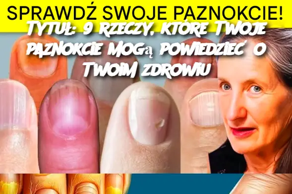 9 rzeczy, które Twoje paznokcie mogą powiedzieć o Twoim zdrowiu