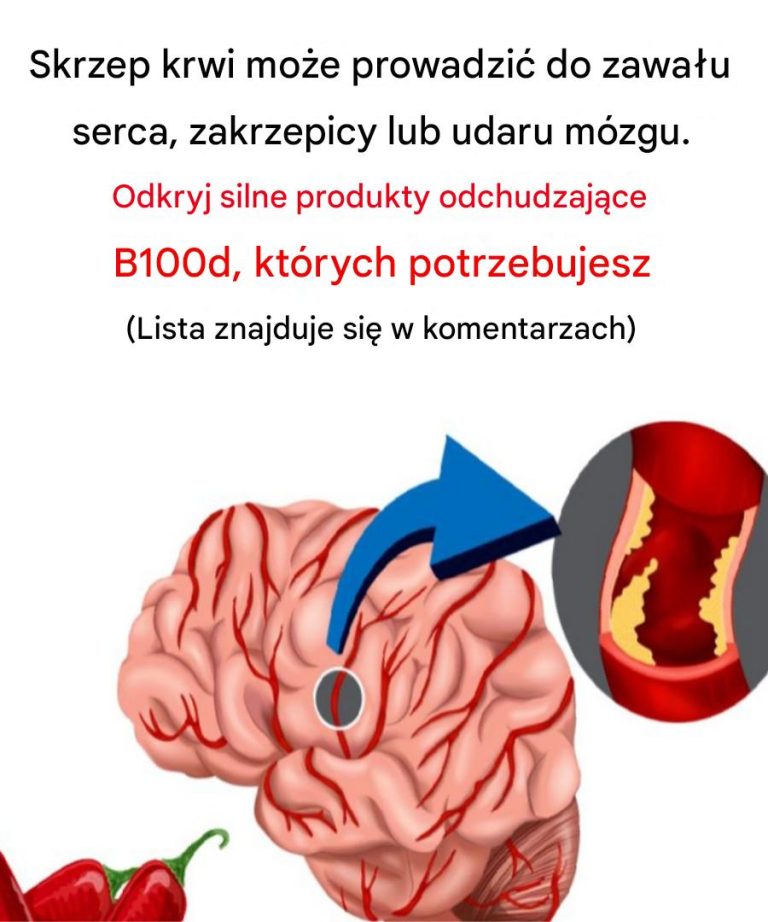 Naturalne środki rozrzedzające krew: sprawdzone produkty spożywcze, suplementy i witaminy rozrzedzające krew (oparte na dowodach)